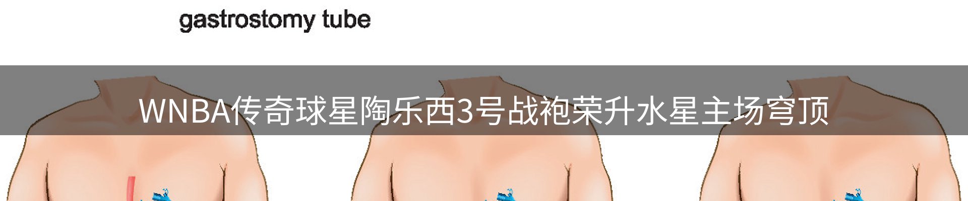 资讯汇编